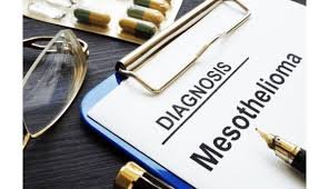 Mesothelioma Lawsuit Settlement Amounts