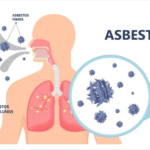 the Health Effects of Mesothelioma