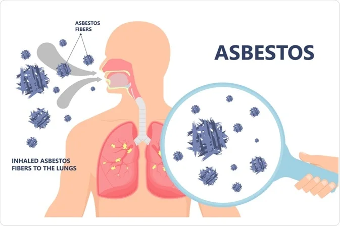 the Health Effects of Mesothelioma