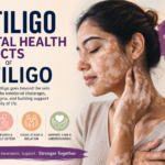 Mental Health Effects of Vitiligo